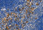 FASTKD3 Polyclonal Antibody