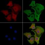 CDK10 Antibody in Immunocytochemistry (ICC/IF)