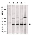 TSN Polyclonal Antibody