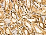 ASC1 Polyclonal Antibody