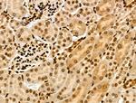 ASC1 Antibody in Immunohistochemistry (Paraffin) (IHC (P))
