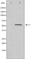 ZNF187 Antibody in Western Blot (WB)