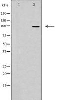 FASTKD1 Antibody in Western Blot (WB)