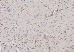 CDKL4 Polyclonal Antibody