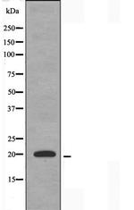 TNFAIP8L2 Polyclonal Antibody