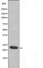 AKAP14 Polyclonal Antibody