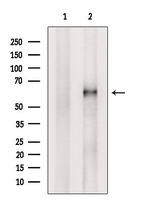 ACRBP Polyclonal Antibody