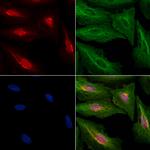 PPHLN1 Antibody in Immunocytochemistry (ICC/IF)