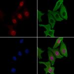 ZNF397 Polyclonal Antibody