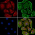 ANKK1 Polyclonal Antibody