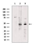 IPMK Polyclonal Antibody