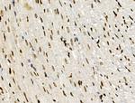 PPP1R14C Antibody in Immunohistochemistry (Paraffin) (IHC (P))
