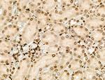 PPP1R14C Antibody in Immunohistochemistry (Paraffin) (IHC (P))