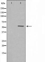 ZNF596 Antibody in Western Blot (WB)