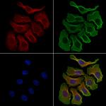 GRK7 Polyclonal Antibody