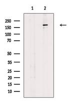MADD Polyclonal Antibody