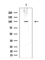 CNKSR2 Antibody in Western Blot (WB)