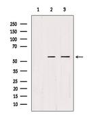 CDKL2 Polyclonal Antibody