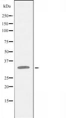 DLX4 Antibody in Western Blot (WB)