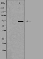 BRF1 Polyclonal Antibody