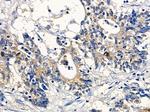 CNKSR1 Antibody in Immunohistochemistry (Paraffin) (IHC (P))