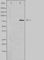 CNKSR1 Antibody in Western Blot (WB)