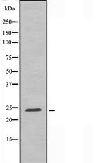 MOB3A/MOB3B Polyclonal Antibody