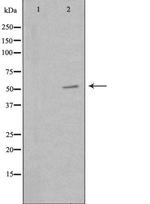 PKNOX2 Polyclonal Antibody