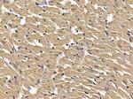 LMTK3 Polyclonal Antibody