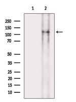 LMTK3 Antibody in Western Blot (WB)