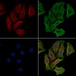 RPS6KC1 Antibody in Immunocytochemistry (ICC/IF)