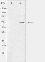 MEKK3 Polyclonal Antibody