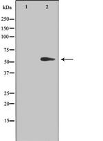 TIN2 Polyclonal Antibody
