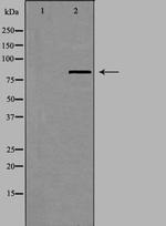 UTP14A Polyclonal Antibody