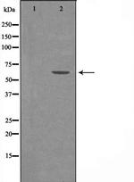 YTHDF1 Polyclonal Antibody