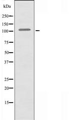 XRN2 Polyclonal Antibody