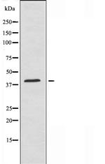 ZNF435 Antibody in Western Blot (WB)