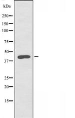 Lass4 Polyclonal Antibody