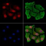 ARNT2 Polyclonal Antibody