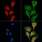 CARKL Polyclonal Antibody