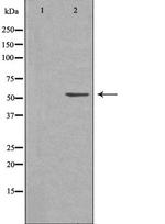 CARKL Antibody in Western Blot (WB)