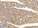 JIP3 Polyclonal Antibody