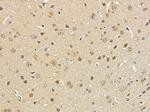 SPIN1 Polyclonal Antibody