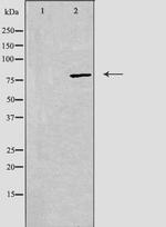 beta Adducin Polyclonal Antibody