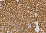 RALGAPA2 Antibody in Immunohistochemistry (Paraffin) (IHC (P))
