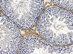 AVEN Antibody in Immunohistochemistry (Paraffin) (IHC (P))