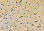 CADM3 Antibody in Immunohistochemistry (Paraffin) (IHC (P))