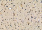 CADM3 Antibody in Immunohistochemistry (Paraffin) (IHC (P))