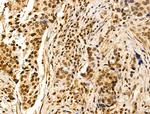CDCA2 Polyclonal Antibody