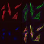 CDCA3 Polyclonal Antibody